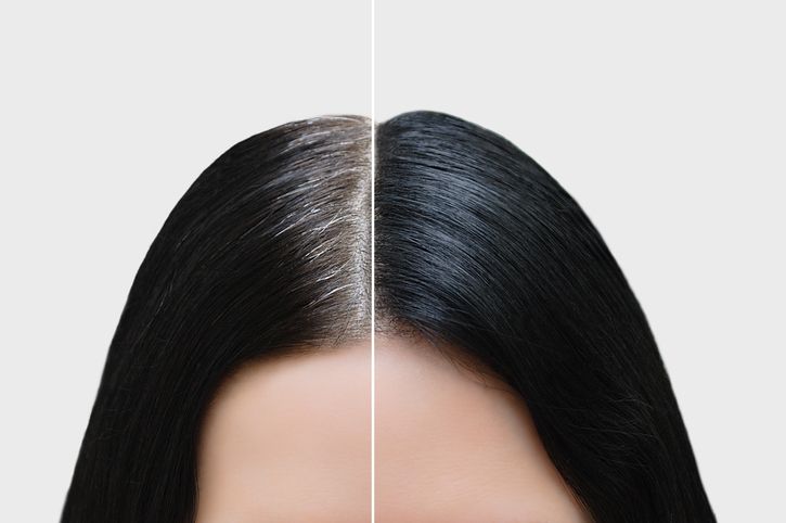 如何讓白頭髮變少？專家推薦5大方法，科學揭秘黑色素幹細胞能讓你頭髮可以黑回來！