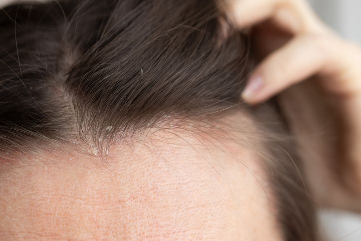 健康頭皮顏色 1.jpg