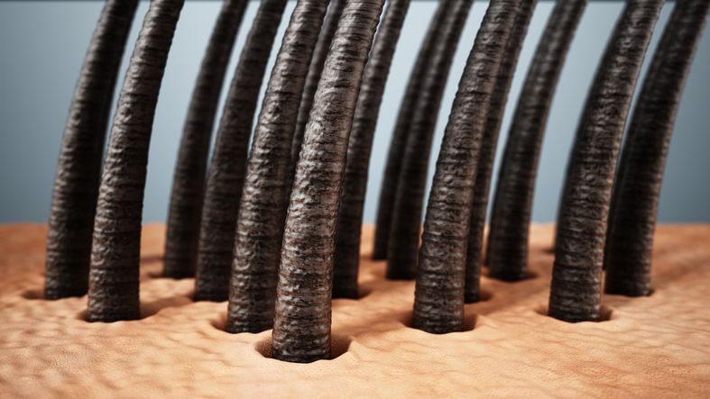 頭髮密度低=脫髮？6種生髮營養+4個護髮習慣=逆轉稀疏髮量！專業醫師解析3種專業脫髮治療！