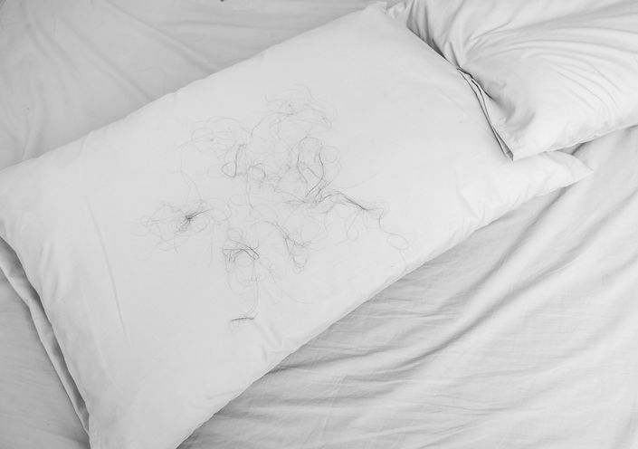 如何判斷雄性禿？專家詳解5大關鍵徵兆與4步自測方法，1分鐘看懂雄性禿的診斷過程！