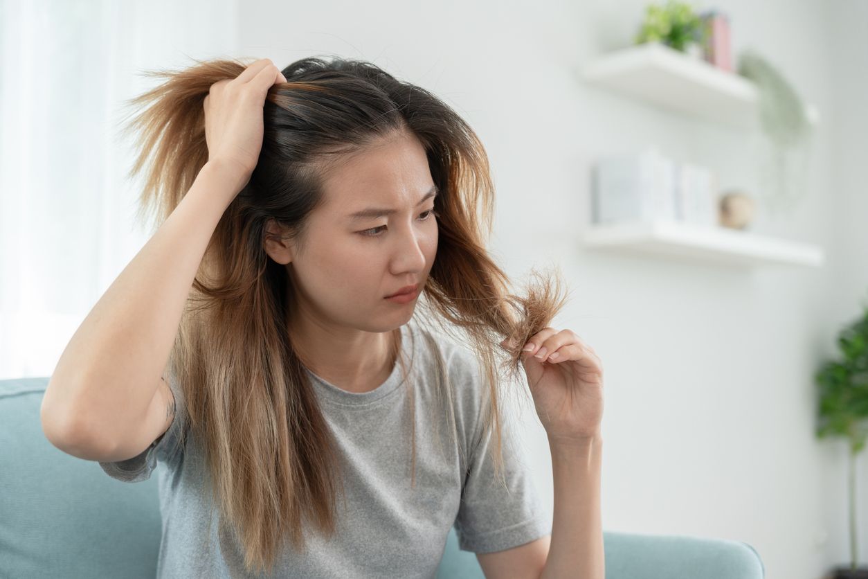 女性禿頭1